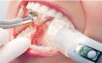 Is it Safe to Visit Your Dentist? Safety Measures in Beverly Hills Examined